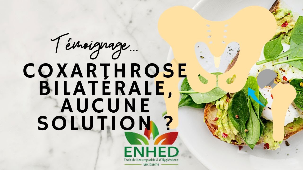 Témoignage Coxarthrose bilatérale de Corinne