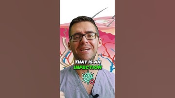 How to Get Rid of Blisters on Feet [How to Cure Blisters FAST!]