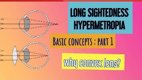 HYPERMETROPIA || BASICS to ADVANCED||
