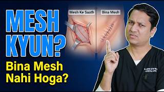 WARNING: Hernia Mesh Lagwane Se Pehle Ye Video Dekho | SIDE EFFECTS in Hindi