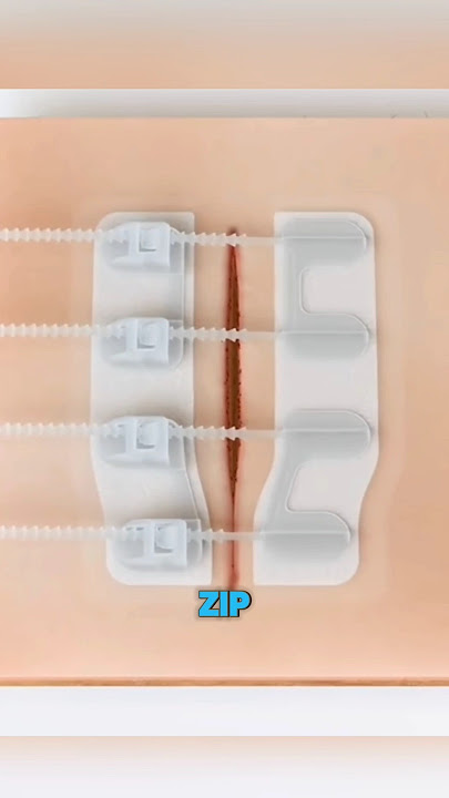 Genius Stitches That Don’t Leave Scars