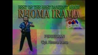 Rhoma Irama - Perbedaan