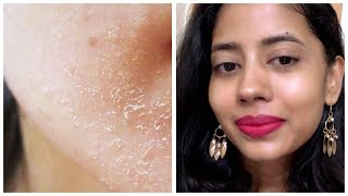 How I turned my Dry Flaky Skin into Radiant Glowing Skin in 1 Step