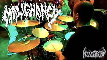 MALIGNANCY [Live Drum Cam] Jimmy