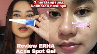 REVIEW ERHA ACNE SPOT GELHASILNYA REAL BANGET