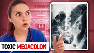 TOXIC MEGACOLON: Day in the Life of a Doctor