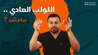 اللولب ما له وما عليه - ببلاش ؟