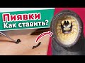 Гирудотерапия - лечение пиявками / Как ставить пиявки правильно?