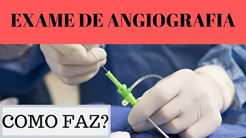 Quanto tempo demora para fazer uma angiografia?