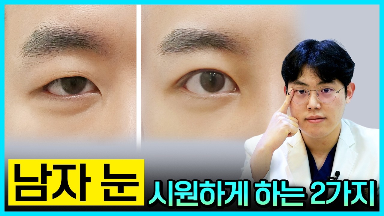 #눈성형 #눈수술 #남자눈 #쌍꺼풀 #쌍꺼풀수술 #쌍수 #눈매교정 #박철흠 #제이준성형외과피부과