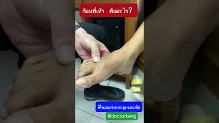 ก้อนที่เท้า คืออะไร #หมอเก่งกระดูกและข้อ #ก้อน