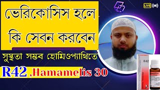 R42 | ভেরিকোসিল এর হোমিওপ্যাথিক চিকিৎসা | ভেরিকোসিল রোগের হোমিওপ্যাথি চিকিৎসা | Homoeo medicine R42