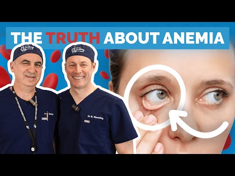 Anemia Maybe It S Due To Low Iron