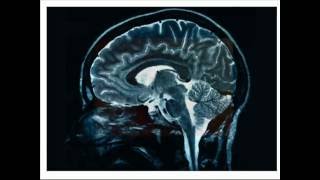 Brain Awareness Video Contest: Population Coding: Mind Reading and More