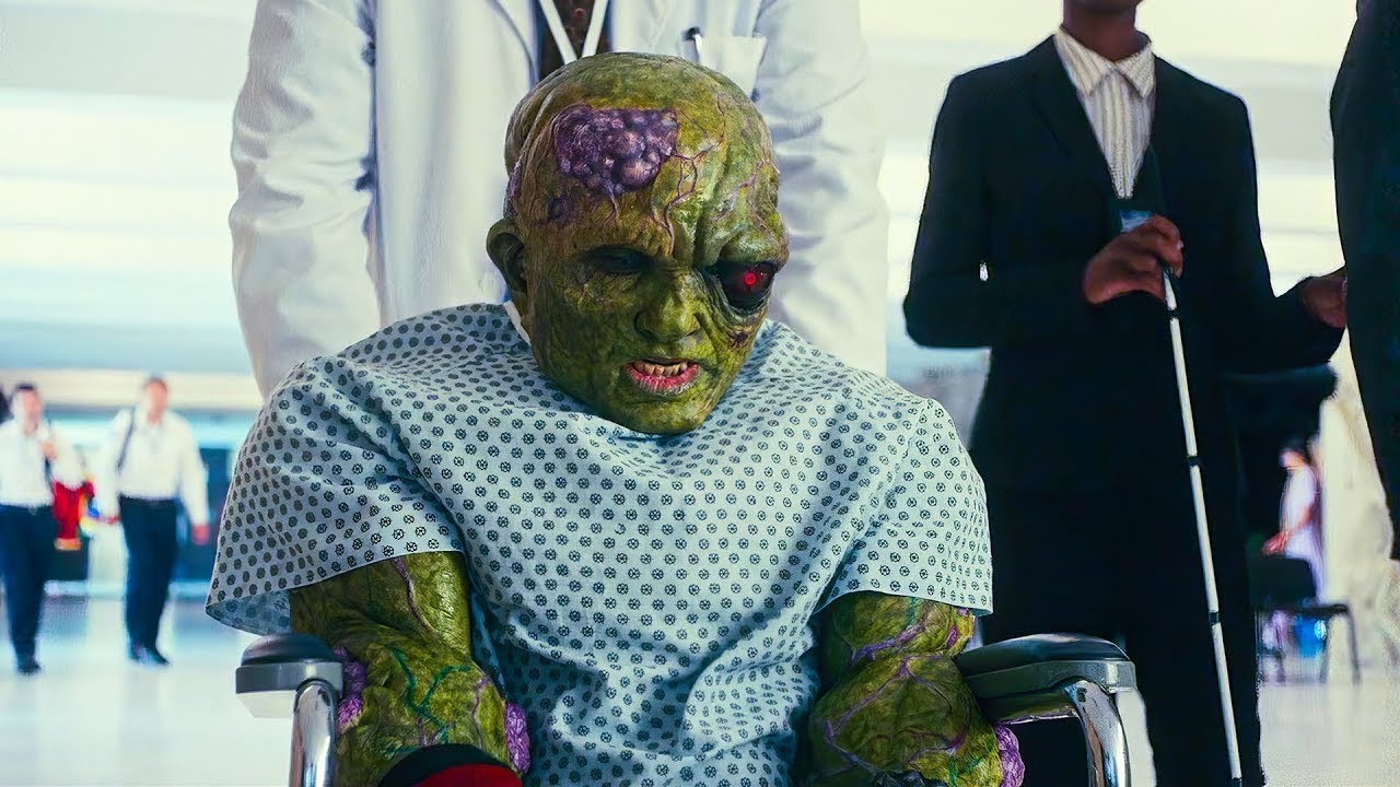 O’qimagan DOKTORLAR tufayli Bemor Daxshatli MUTANTGA aylandi!