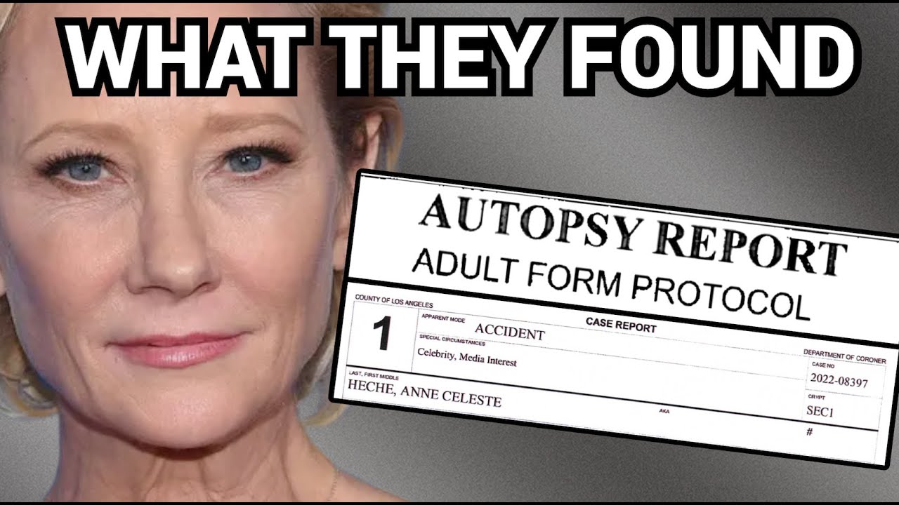 The REAL Story Behind Anne Heche's Fatal Crash