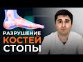 Тайна болезни Ренадера-Мюллера: Почему болит палец стопы и как избавиться от боли?