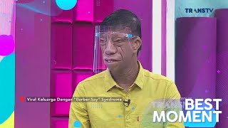 Fisik Berbeda Karena Sindrom Langka, Keluarga Manurung Makin Eksis | Best Moment #Rumpi (15/2/22)