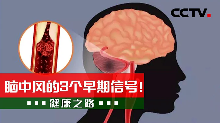 脑中风的3个早期信号！你身边有这些表现吗？20210311 |《健康之路》CCTV科教 - 天天要闻