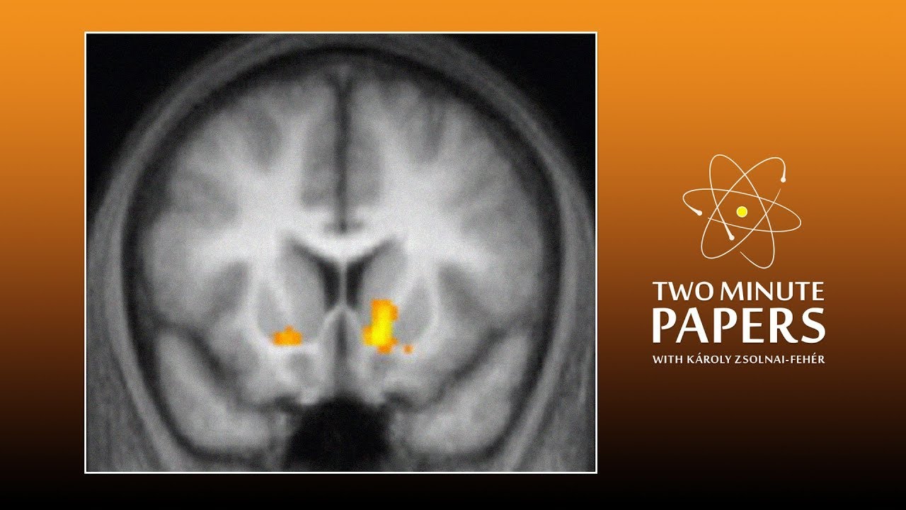 Should AI Research Try to Model the Human Brain?