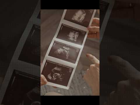 لما تحملي حالك فوق طاقتك جسدك بيصرخ بلشي تخلصي من هالحمل وكل شي فيك رح يرتاح تحرر شفاء انثى