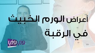 أعراض الورم الخبيث في الرقبة