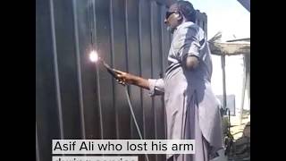 Smart Prosthetic Arms for Amputees- Brain-controlled and AI embedded!