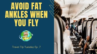 How to Avoid Swollen Ankles When Flying | Avoid Fat Ankles When Traveling | Stay Healthy When Flying