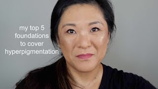 my top 5 best foundations for hyperpigmentation
