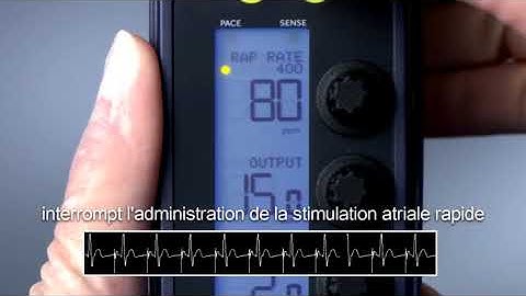 53401 Rapid Atrial Pacing