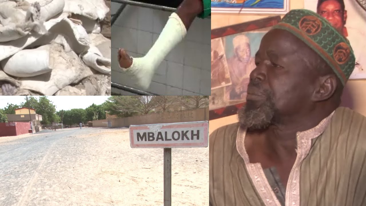 INCROYABLE DÉCOUVERTE. COMMENT ON SOIGNE LES FRACTURES A MBALOKH