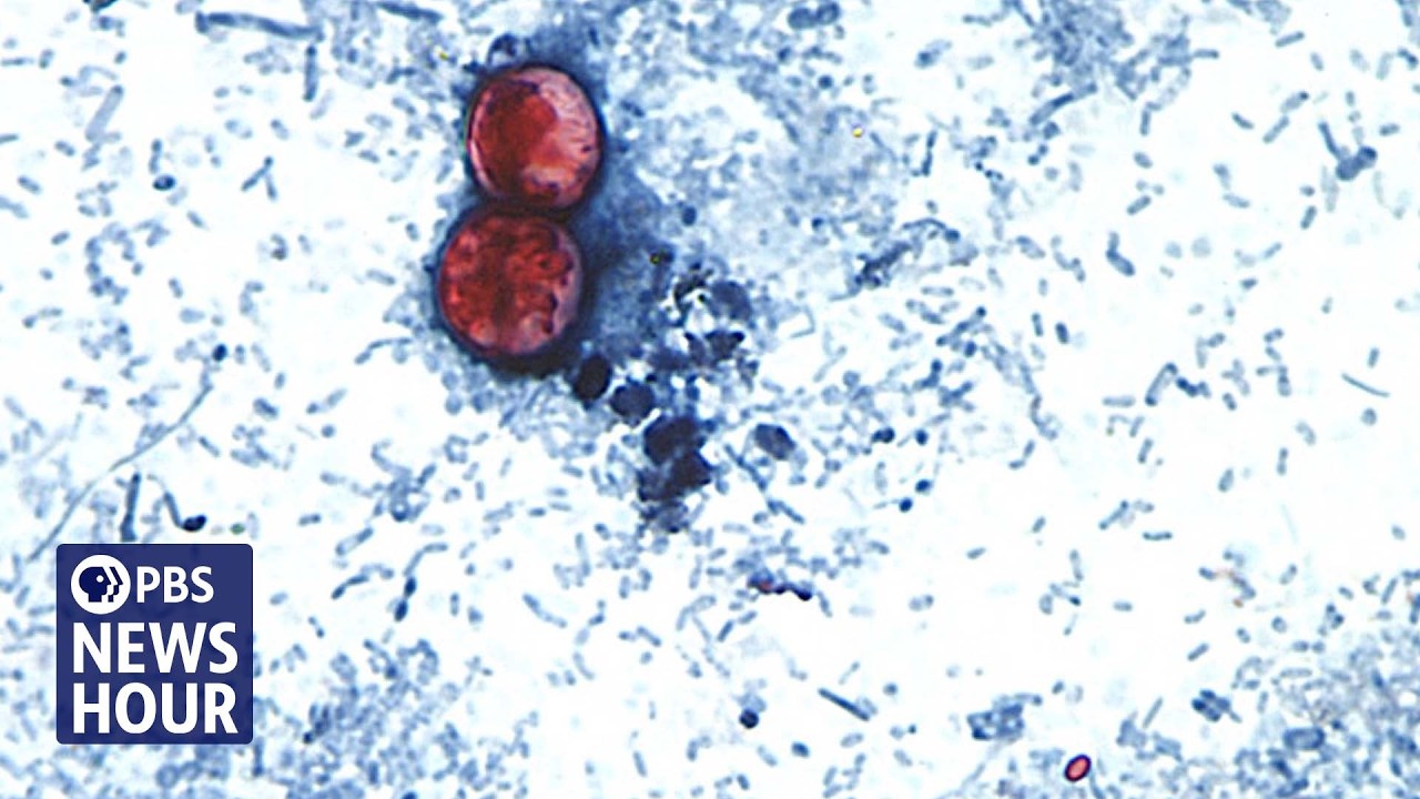 Outbreak Investigation Challenges: The Case of Cyclosporiasis