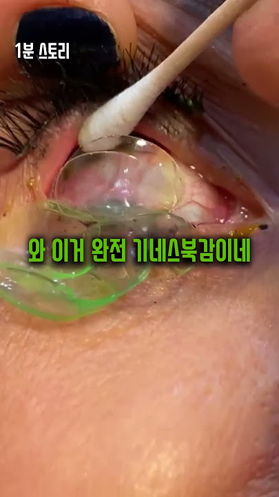 눈에서 몇개나 나오는거야? #shorts