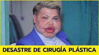 12 Celebrities Before and After Plastic Surgery | Then and Now 2026