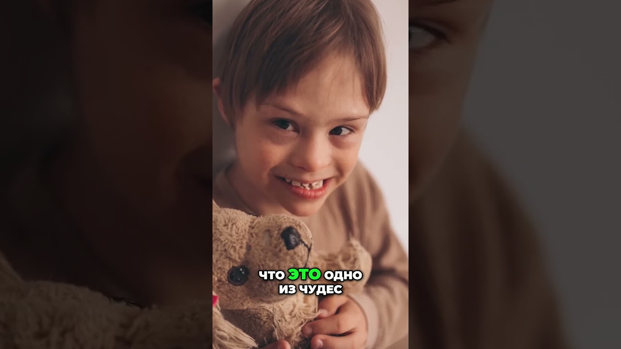 Чудо Медицины: Крис Выжил, Несмотря на Диагноз парок сердца #синдромдаунанеприговор #здоровье #семья