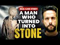 Most Mysterious Medical Case I Story Of Harry EastLack I Rare Case Of FOP I Ashu Ghai