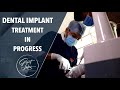 Dental Implant work in Progress | Basal Implant | Denture | Best Dental Implant Clinic in Kolkata