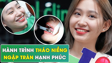 Hành trình tháo mắc cài niềng răng sau hơn 2 năm chờ đợi || Bác sĩ Yến Yteeth