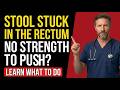 Senior Health Advice: Stool STUCK in the Rectum! What is it and what to do? | After 70