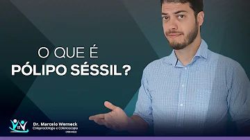 O que é um pólipo séssil?