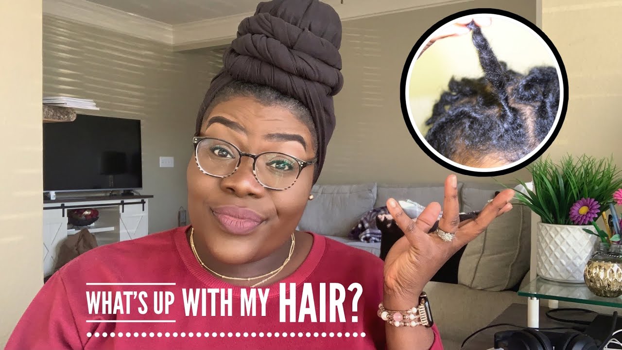 Starter Loc Stage | Should My Locs Look Like This | 0-12 months