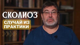 Когда спина кричит о помощи: история одного сколиоза
