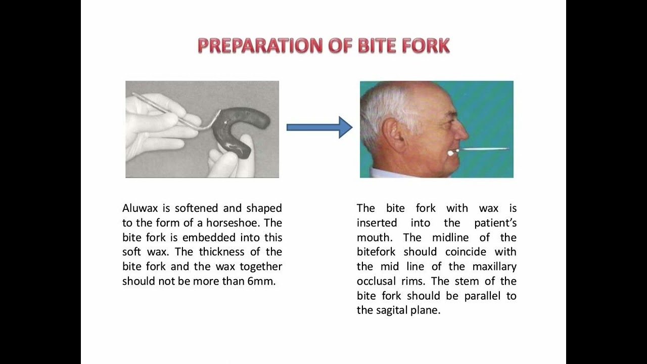 Orientation jaw relation