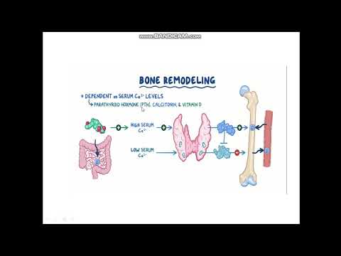 Video: 10 Salah Tanggapan Mengenai Osteoporosis