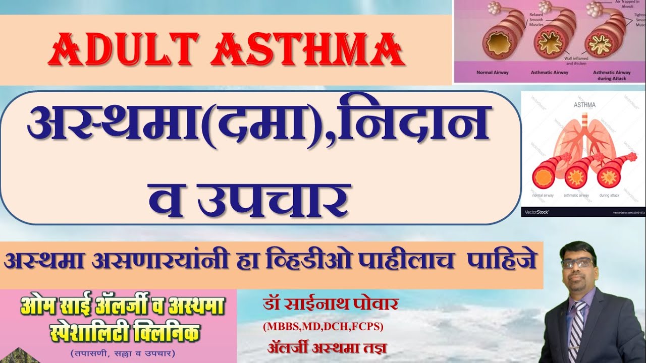 अस्थमा(दमा),निदान व उपचार,अस्थमा आता भीती कशाची,जोड त्याला आधुनिक उपचारांची,Adult Asthma Unfolded.