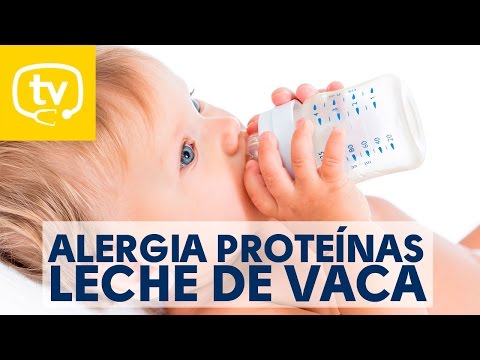 Vídeo: Alergia A La Leche En Bebés - Alergia A La Proteína De Leche De Vaca En Bebés