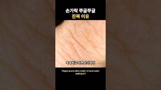 손가락 쭈글쭈글 진짜 이유
