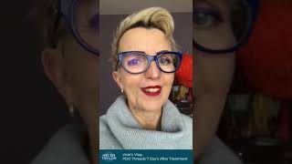 Vickis Vlog - Pdo Threads - 7 Days After Treatment