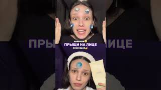 Как избавиться от прыщей🤌 поможет грамотное очищение. арт WW134564 озон 2195940525 #прыщи #уход