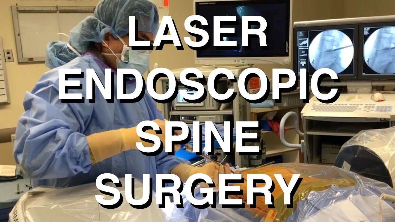 Laser Endoscopic Spine Surgery (LESS) YouTube